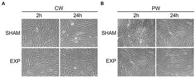 Study of genotoxic and cytotoxic effects induced in human fibroblasts by exposure to pulsed and continuous 1.6 GHz radiofrequency
